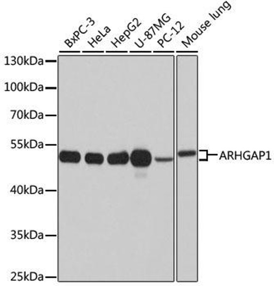 Anti-ARHGAP1 Antibody (CAB3739)