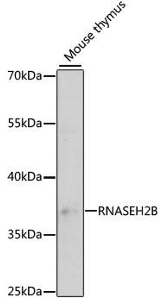 Anti-RNASEH2B Antibody (CAB4972)