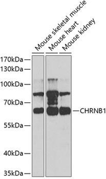 Anti-CHRNB1 Antibody (CAB5295)