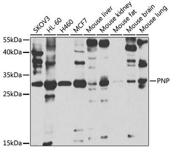 Anti-PNP Antibody (CAB5778)