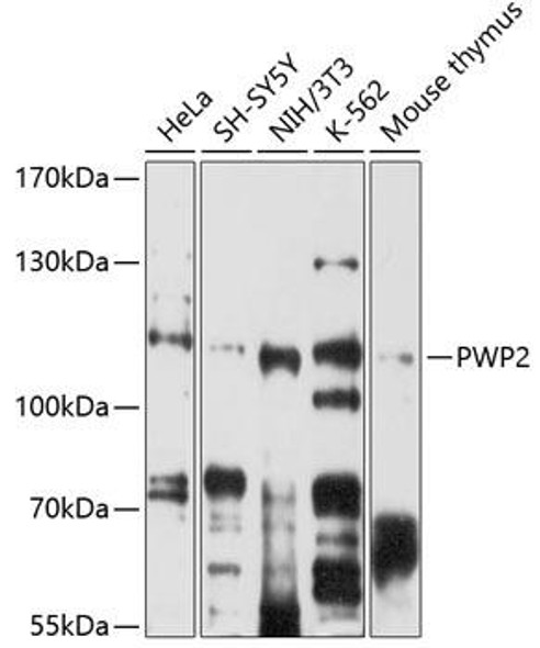Anti-PWP2 Antibody (CAB5929)