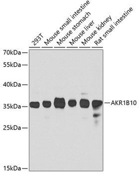 Anti-AKR1B10 Antibody (CAB7823)