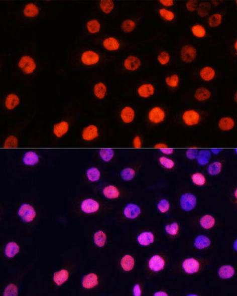 Anti-MonoMethyl-NONO-R357/R365 Antibody (CAB8087)