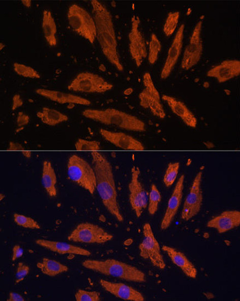 Anti-SIRPA Antibody (CAB9001)