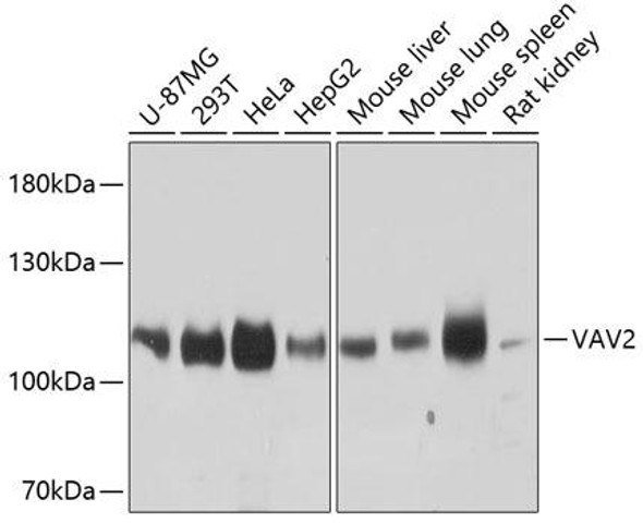 Anti-VAV2 Antibody (CAB9483)