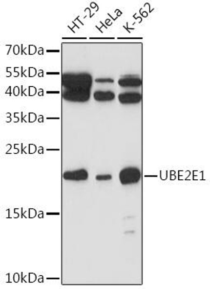 Anti-UBE2E1 Antibody (CAB13912)
