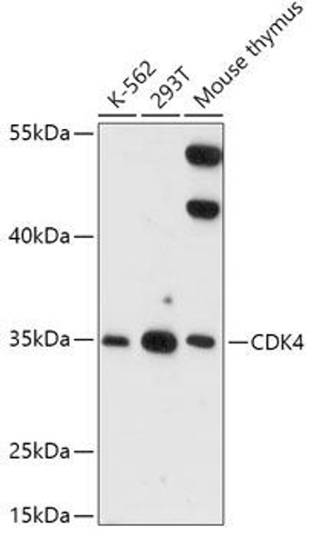 Anti-CDK4 Antibody (CAB16813)