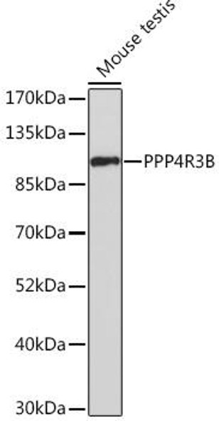 Anti-PPP4R3B Antibody (CAB17189)