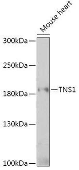Anti-TNS1 Antibody (CAB17544)