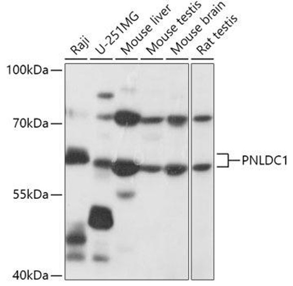 Anti-PNLDC1 Antibody (CAB17838)