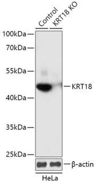 Anti-KRT18 Antibody (CAB18010)[KO Validated]