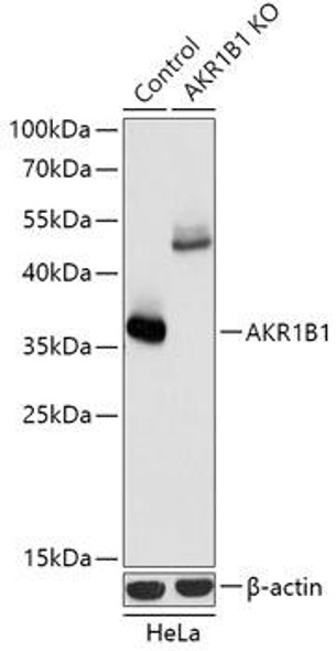 Anti-AKR1B1 Antibody (CAB18031)[KO Validated]