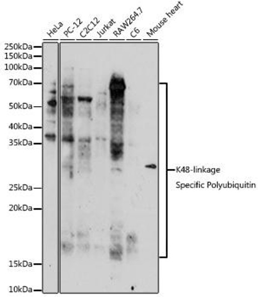 Anti-K48-linkage Specific Polyubiquitin Antibody (CAB18163)