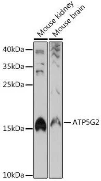Anti-ATP5G2 Antibody (CAB18279)