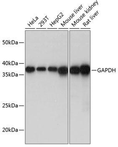 Anti-GAPDH Antibody (CAB19056)