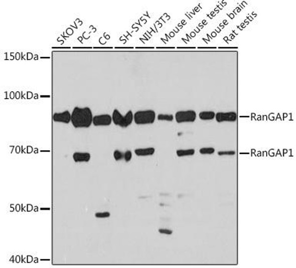 Anti-RanGAP1 Antibody (CAB8758)