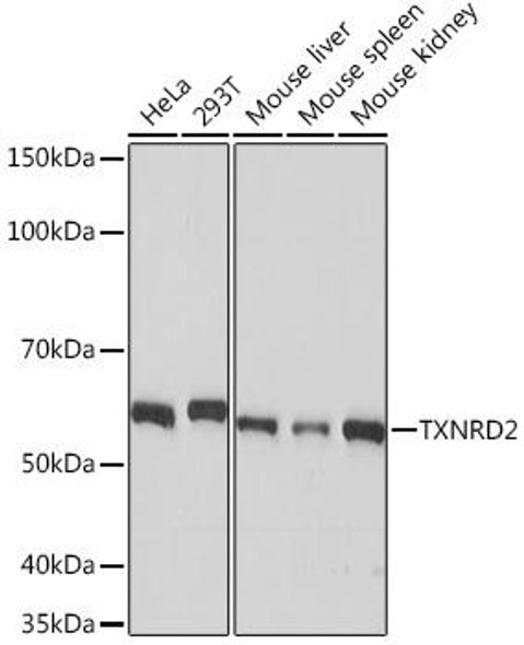 Anti-TXNRD2 Antibody (CAB8884)