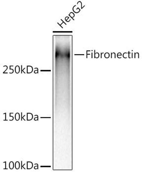 Anti-Fibronectin Antibody (CAB12977)