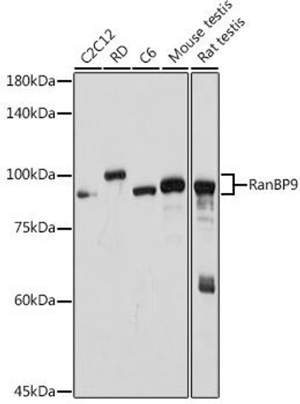 Anti-RanBP9 Antibody (CAB19238)