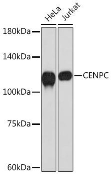 Anti-CENPC Antibody (CAB3975)