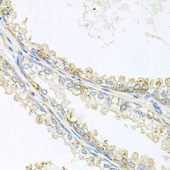 Anti-CD133 Antibody (CAB0219)