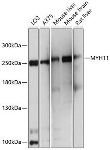 Anti-MYH11 Antibody (CAB10827)