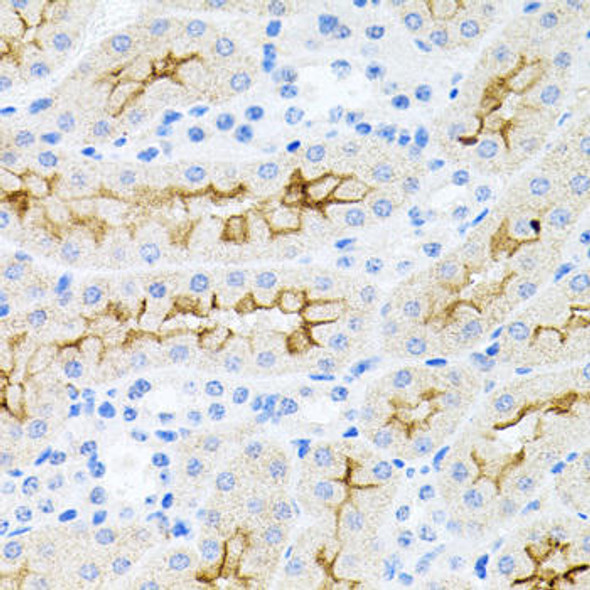Anti-IL-17A Antibody (CAB12454)