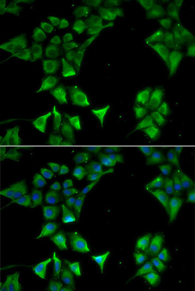 Anti-CD177 Antibody (CAB13597)