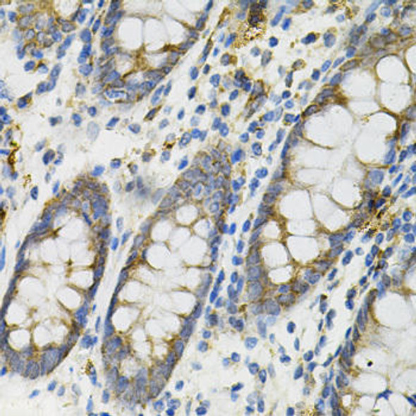 Anti-DEFB132 Antibody (CAB13689)