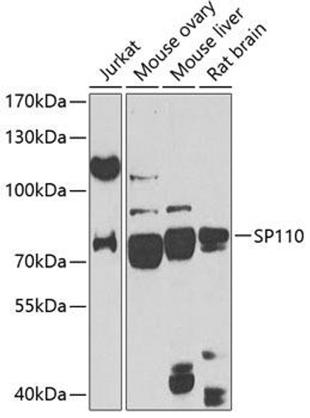 Anti-SP110 Antibody (CAB14003)