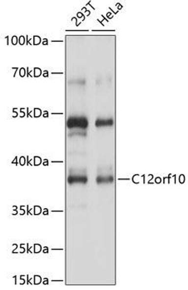 Anti-C12orf10 Antibody (CAB14637)