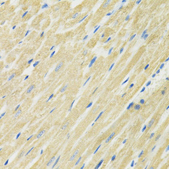 Anti-SLC19A1 Antibody (CAB14644)