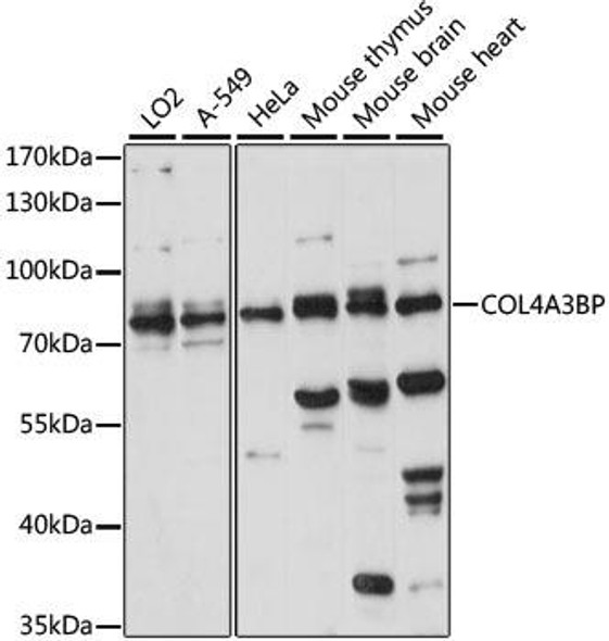 Anti-COL4A3BP Antibody (CAB15376)