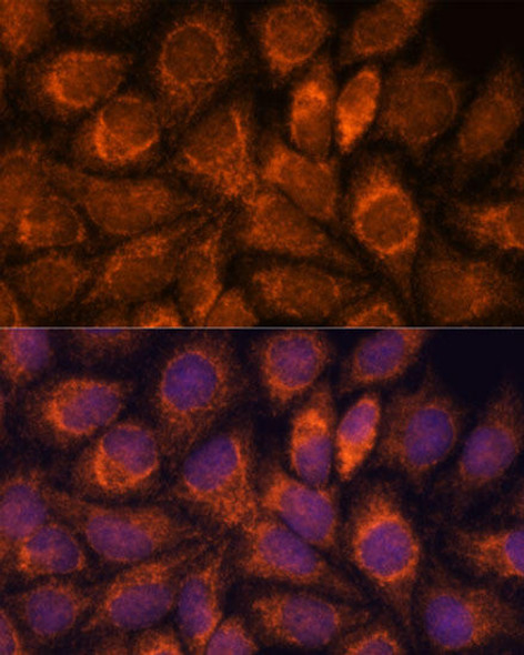 Anti-MRPS14 Antibody (CAB15498)