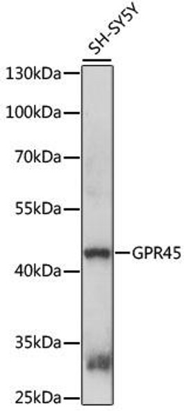 Anti-GPR45 Antibody (CAB15790)