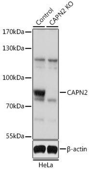 Anti-CAPN2 Antibody (CAB1861)[KO Validated]