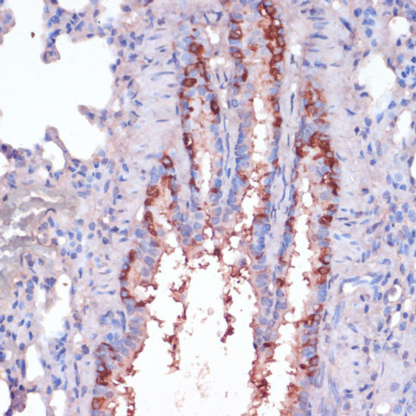 Anti-RPL22 Antibody (CAB9202)