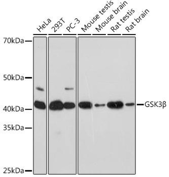 Anti-GSK3Beta Antibody (CAB11731)