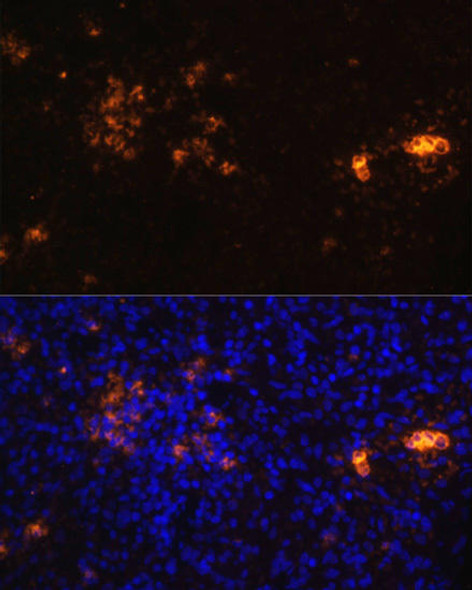 Anti-CD70 Antibody (CAB16809)