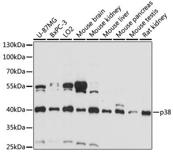 Anti-MAPK14 Antibody (CAB16822)