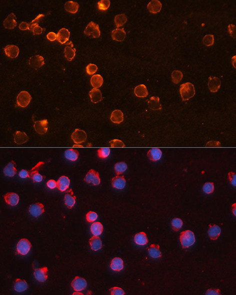 Anti-IL-10 Antibody (CAB17501)