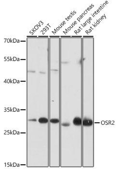 Anti-OSR2 Antibody (CAB18178)