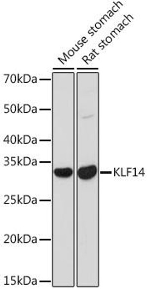 Anti-KLF14 Antibody (CAB18607)