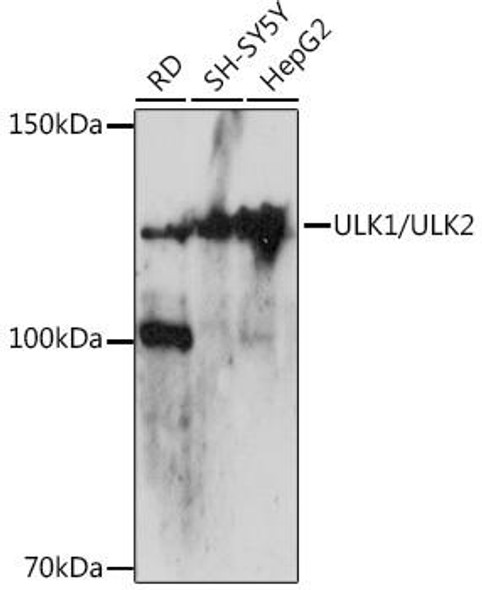 Anti-ULK1/ULK2 Antibody (CAB18685)