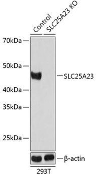 Anti-SLC25A23 Antibody (CAB19877)[KO Validated]