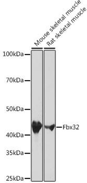 Anti-Fbx32 Antibody (CAB3699)