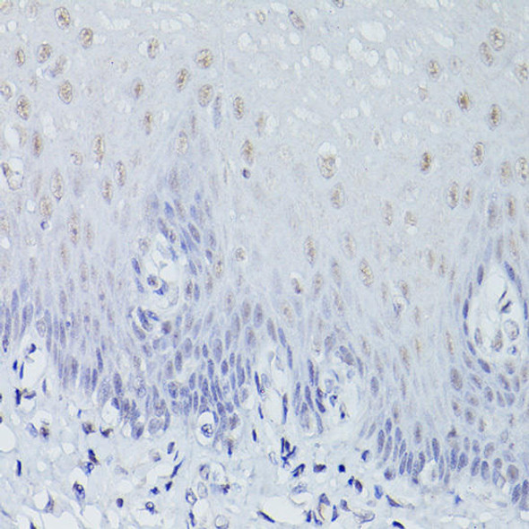 Anti-CLDN18.2 Antibody (CAB20420)