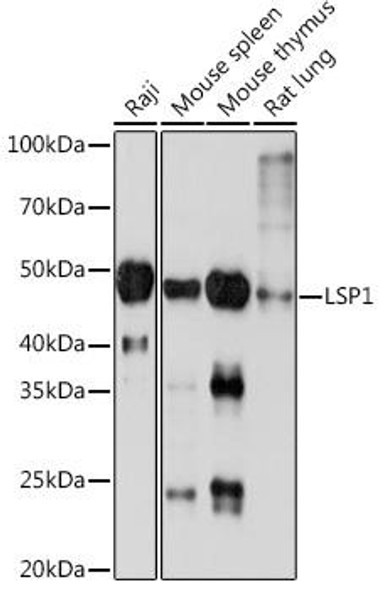 Anti-LSP1 Antibody (CAB3355)