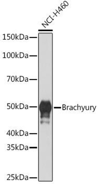 Anti-Brachyury Antibody (CAB5078)