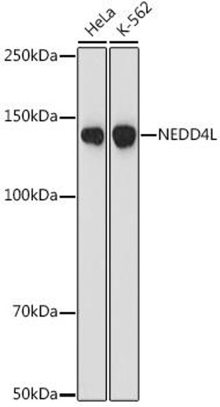 Anti-NEDD4L Antibody (CAB9078)